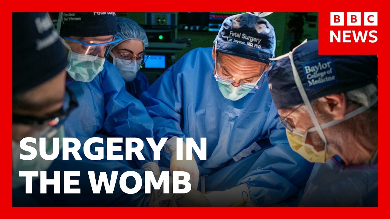 Pioneering womb surgery for ‘miracle’ baby with intestines outside its body | BBC News